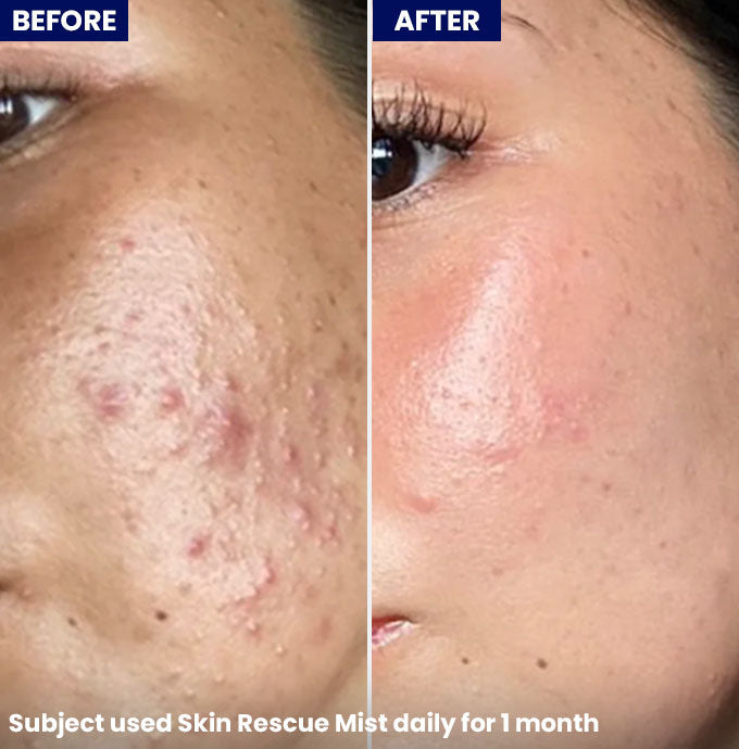 Skin Rescue Mist