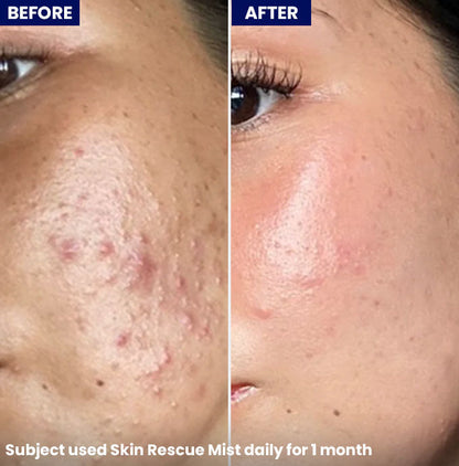 Skin Rescue Mist