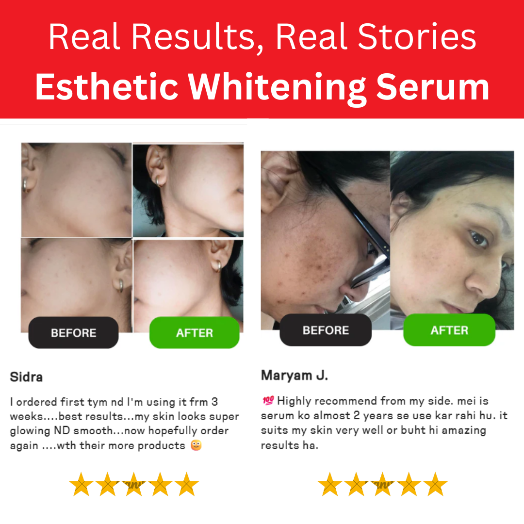 Whitening Serum: Perfect Skin Booster
