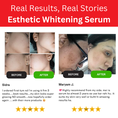 Whitening Serum: Perfect Skin Booster