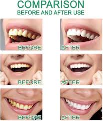 Busaurus Toothpaste, Busaurus Probiotic Whitening Toothpaste Nicotinamide Toothpastes, Remove Tooth Stains, Fresh Breath (1PCS)